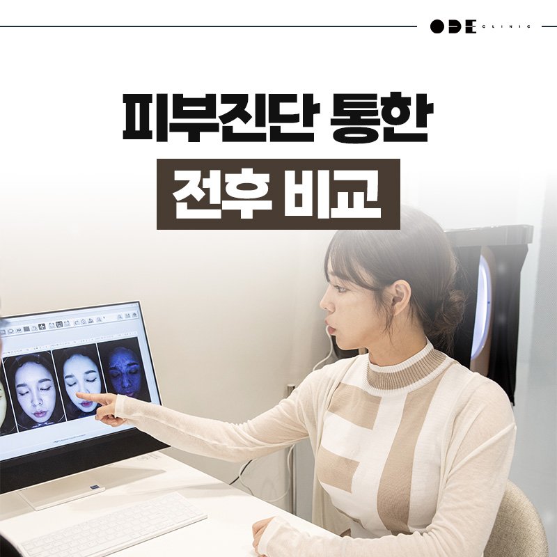 강남 스컬트라 효과
